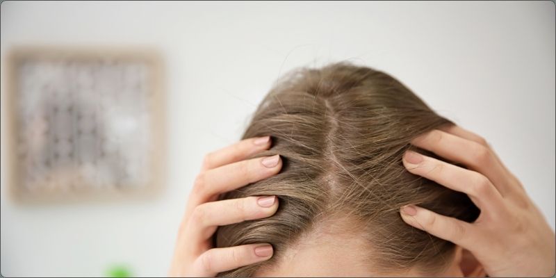 Caduta-dei-capelli.jpg